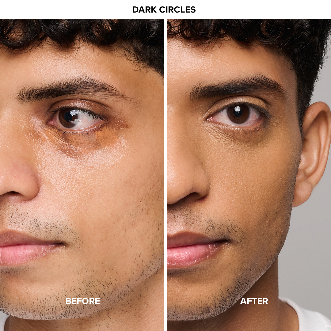 Hydrafit Deep Correction Kit